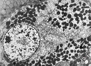 normal mucosa - stomach - parietal cell